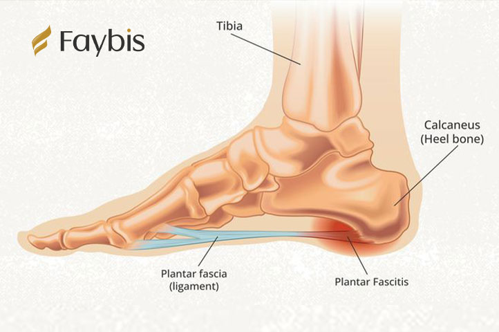 Manage Foot Deformities
