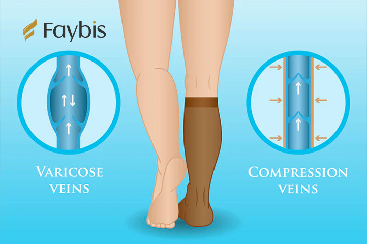 What Are Compression Socks Used For?